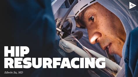 hip resurfacing orthobullets|Orthopaedic: Hip Resurfacing by Edwin P. Su, MD .